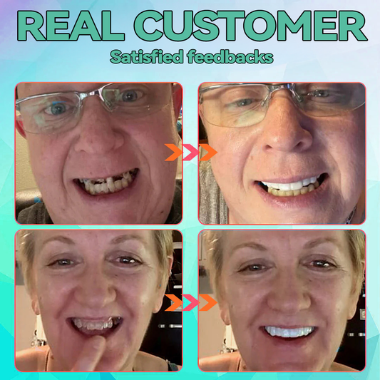 🔥Last Four Hour 70% OFF 🦷 JOTUNLY™ Silicone Reline Denture Set